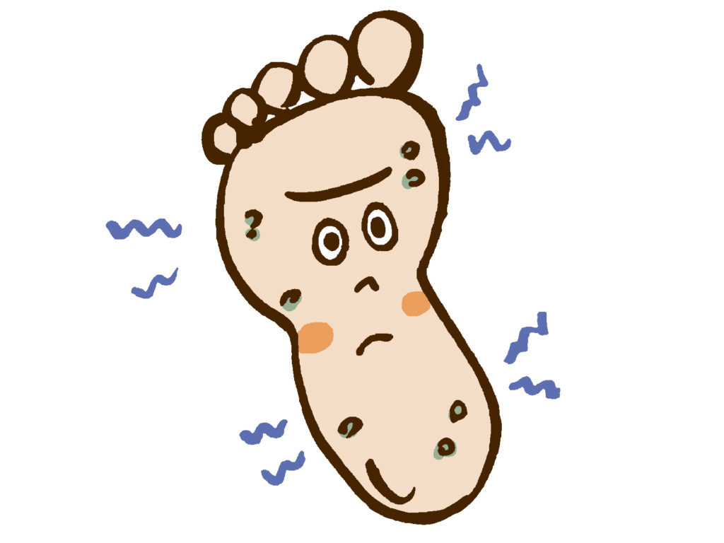 いぼ