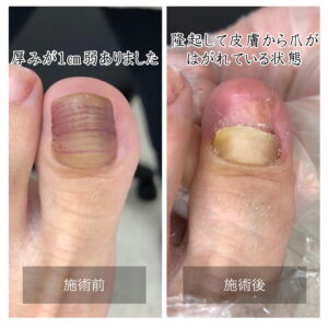 ビフォーアフター