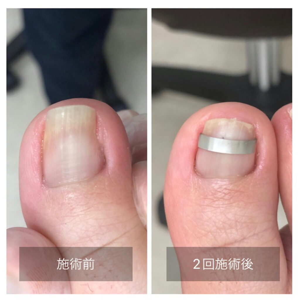 ビフォーアフター