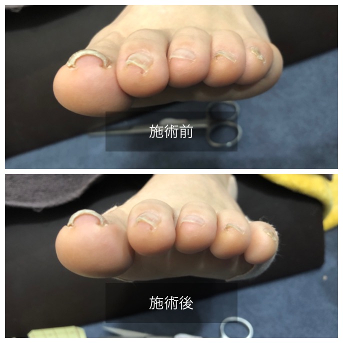 足整体