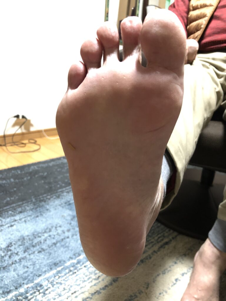 83歳