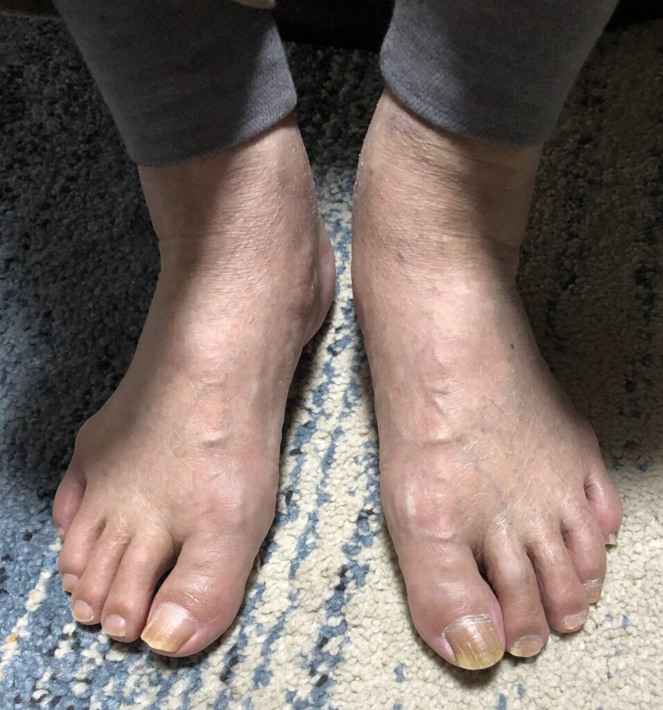 83歳健康の秘訣