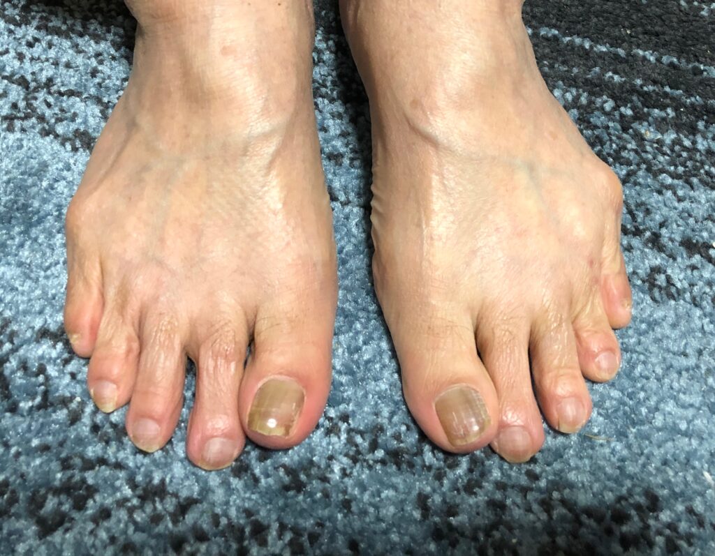 70代後半 健康な足