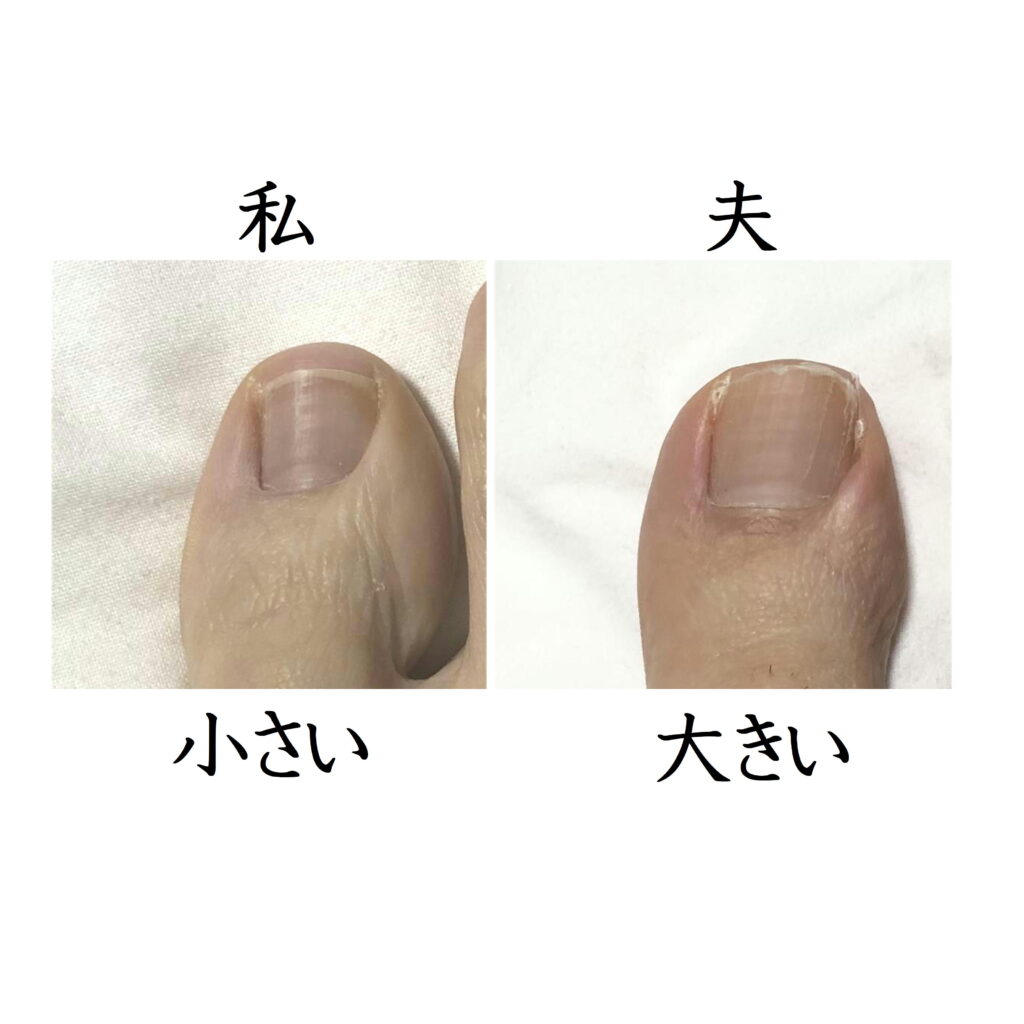 陥入爪1