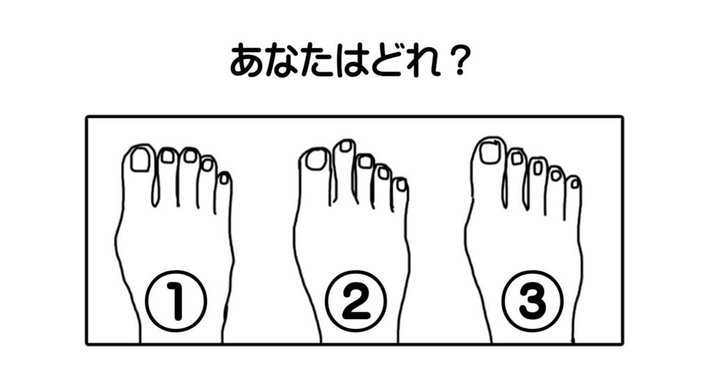 あなたはどれ?