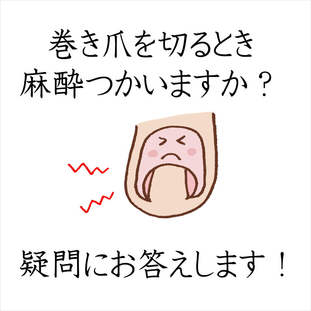 巻き爪 麻酔