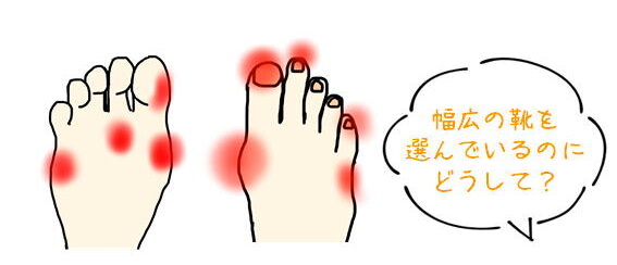つま先トラブル