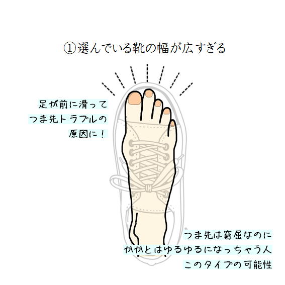 靴のワイズが合っていない