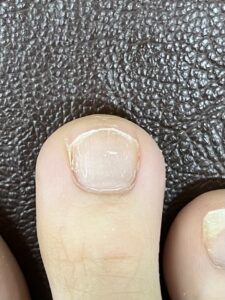 ラウンドオフ