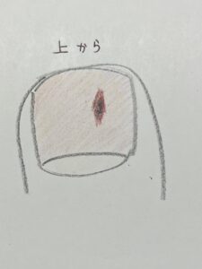 巻き爪じゃないのに痛い爪
