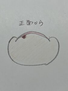 巻き爪じゃないのに痛い爪